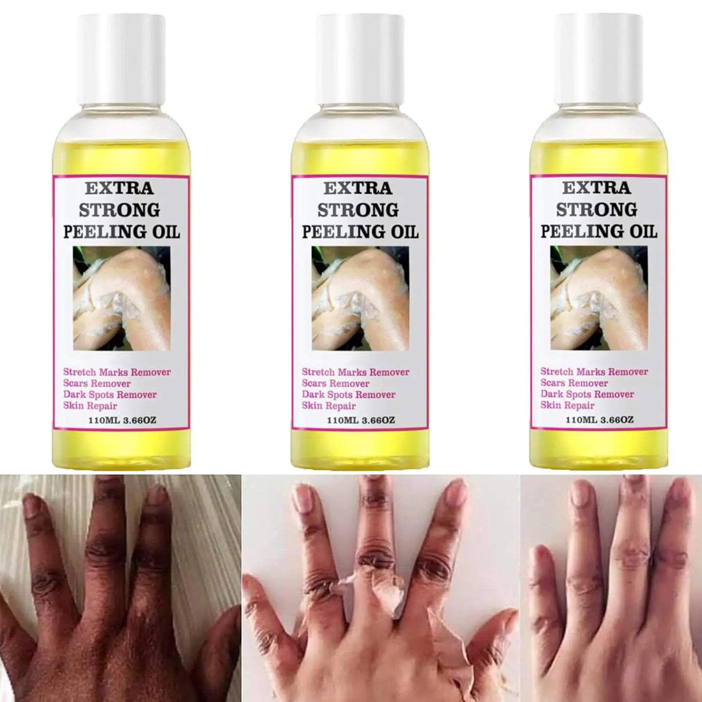 Generic Peeling Oil Extra Strong Peeling Oil Yellow Peeling Oil for Dark Skin Exfoliating Peeling Solution for Body Hand Feet and Face All Skin Type (330ML/11.7 Fl Oz)